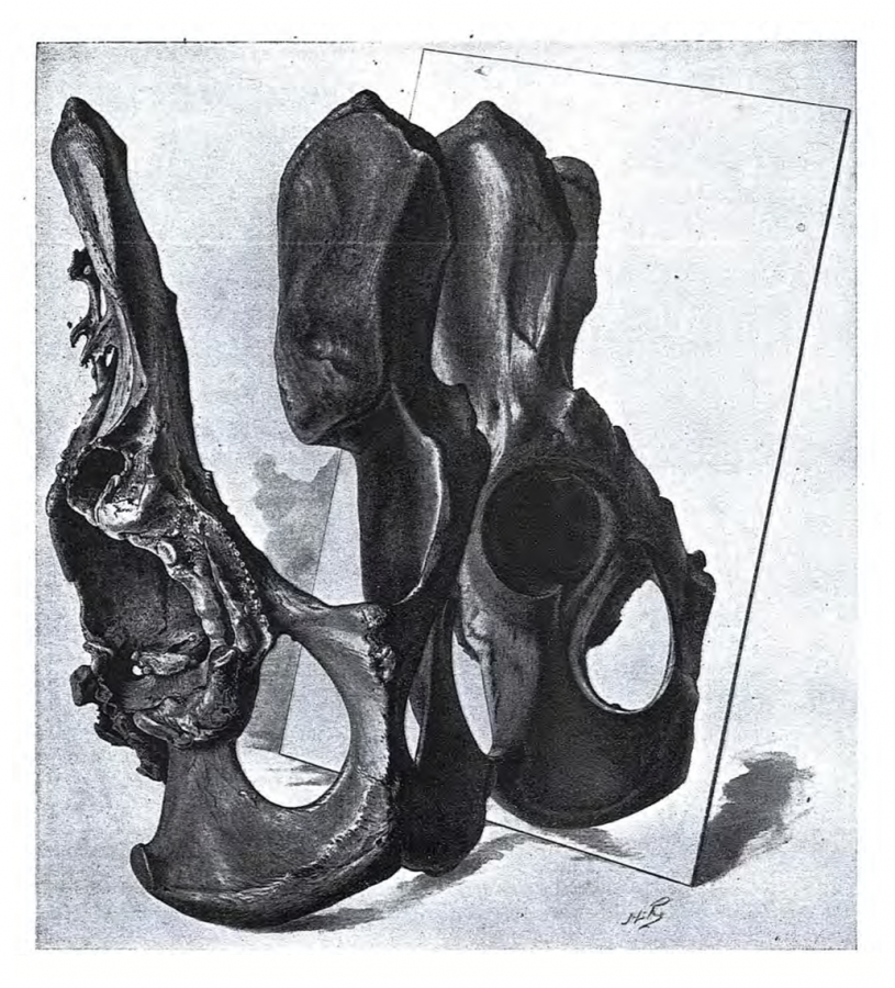 Pelvis-in-mirror image from Moodie’s 1930 paper